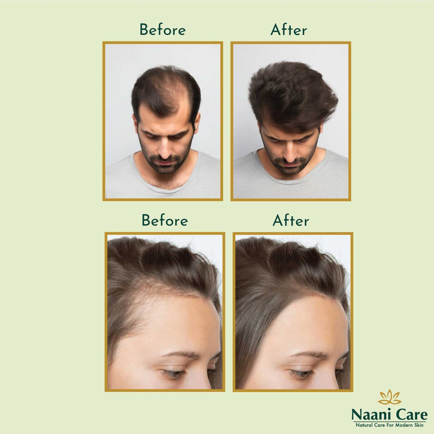 Zaitoon Hair Growth Oil | 100% Organic | 100ml
